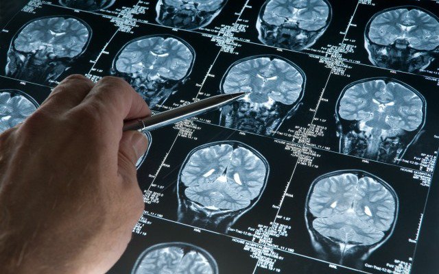 Neuroscientist Shows What Fasting Does To Your Brain & Why Big Pharma Won’t Study It