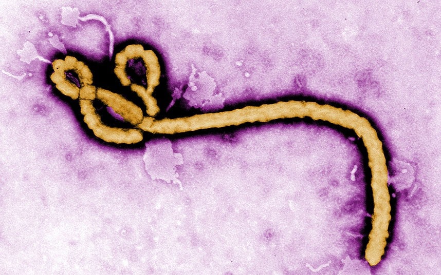 A Telltale Sign A Canadian BioWar Lab Released Ebola In Africa