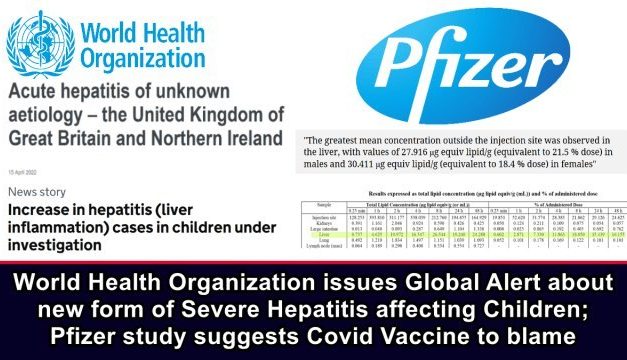 W.H.O. Issues Global Alert about new form of Severe Hepatitis Affecting Children; Pfizer Study Suggests COVID Vaccine to Blame
