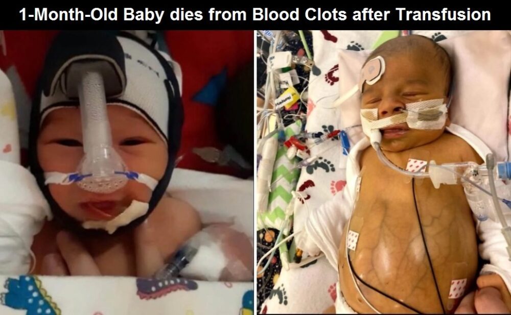 Red Cross Admits They do Not Separate Vaccinated from Unvaccinated Blood – Mother Claims Baby Died from Blood Clots of Donated Blood